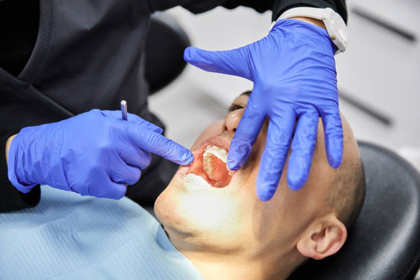 Best Emergency Root Canal Treatment in Jean Fitte, LA